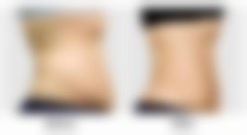 六、泰兴艺形医疗美容门诊部怎么预约：