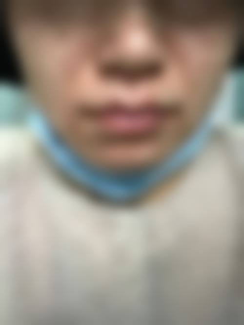 徐小红皮肤美容实例