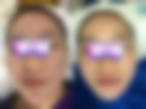 徐小红怎么预约？