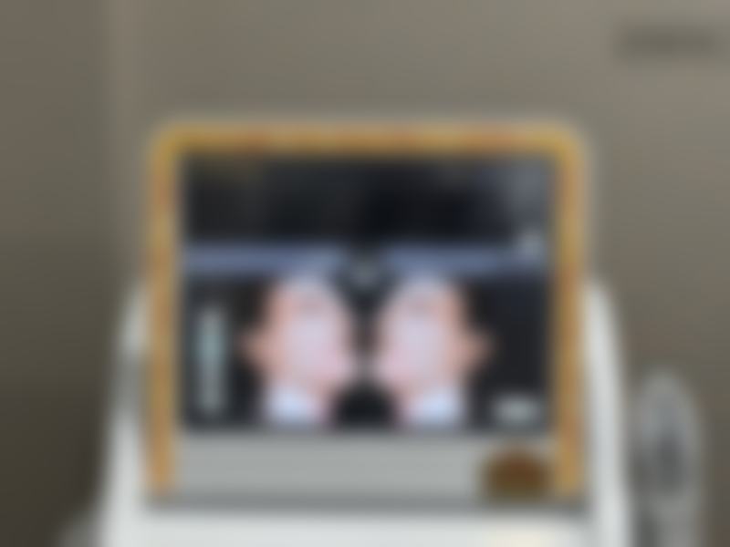 Park Jaewoo皮肤膘肥整容水平怎么样可靠吗？