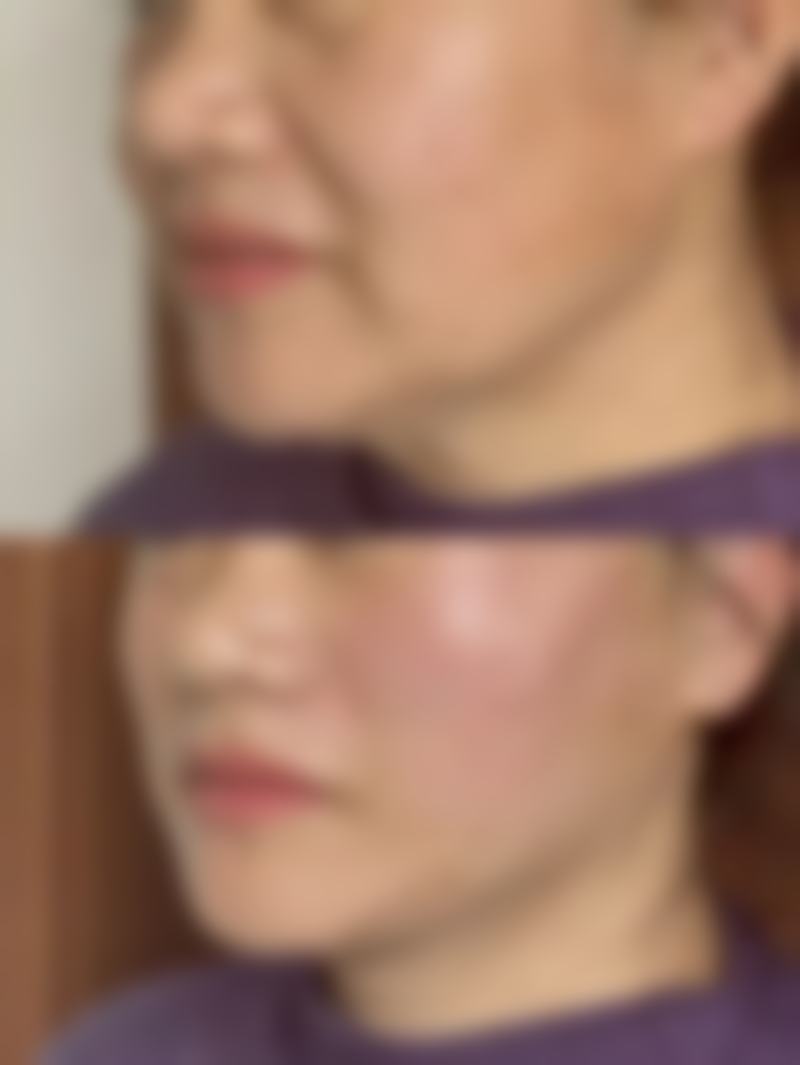 徐小红皮肤美容实例