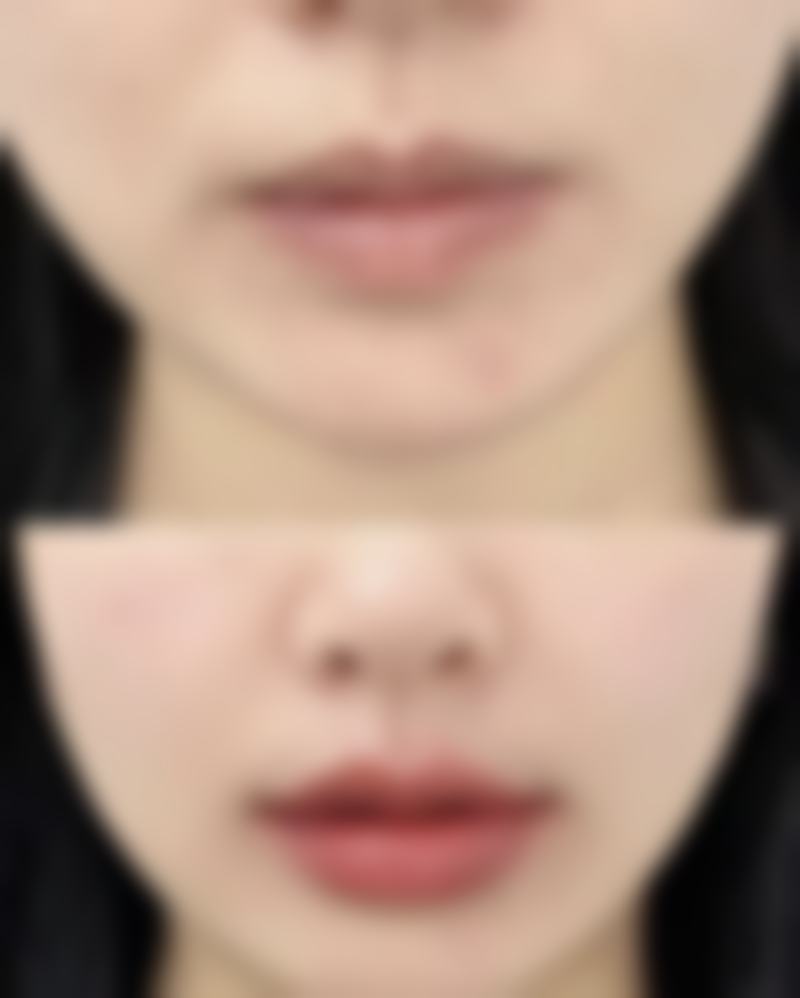 破解眼袋发黑难题，分型调理+日常呵护，让你告别熊猫眼重拾亮眼风采 