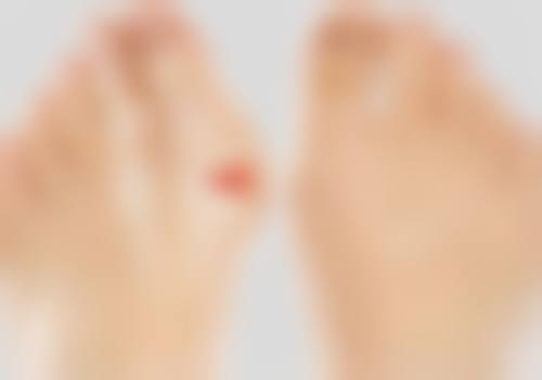 学习应对措施,降低吸脂全麻风险