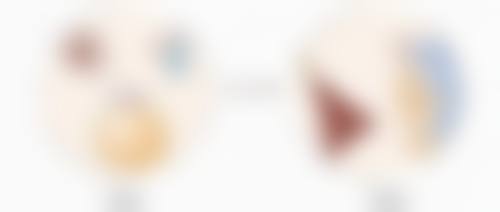 割双眼皮后遗症揭秘：选对医院降低风险