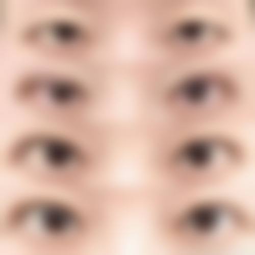 钟毅面部填充实例