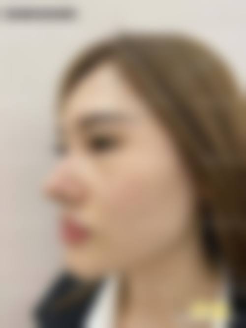 张炜强在哪家医院