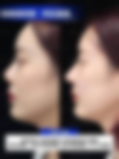 张炜强个人资料及简历