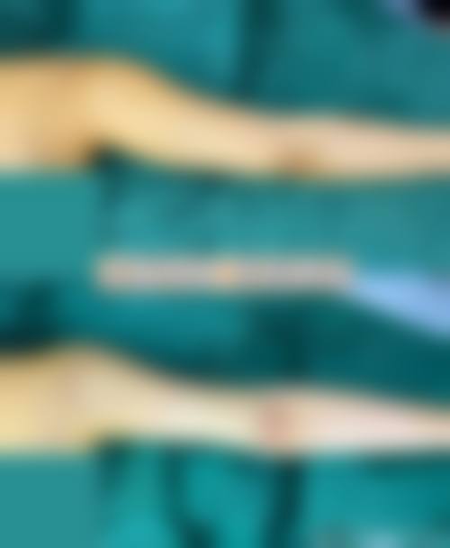 曹经栋眼部整形实例