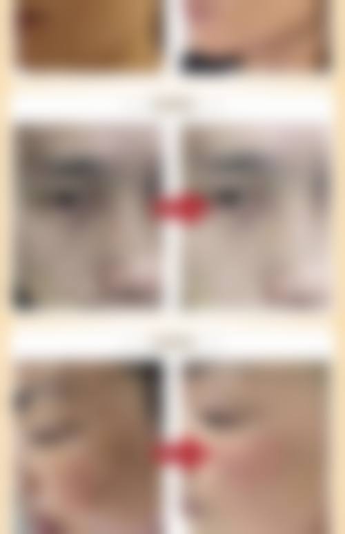 钟贵玲怎么预约？