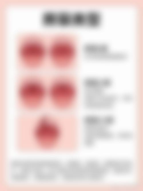 温裕庆唇腭裂修复实例