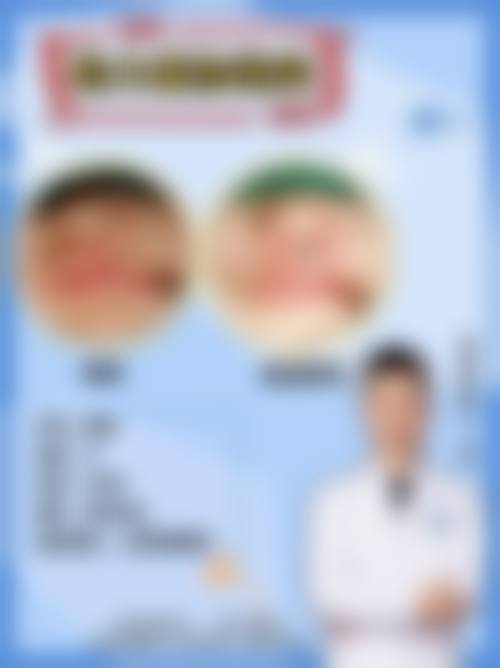 温裕庆唇腭裂修复水平怎么样可靠吗？