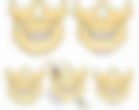 玻尿酸、自体脂肪等注射隆鼻材料大揭秘，适用人群、效果维持时间全知晓 