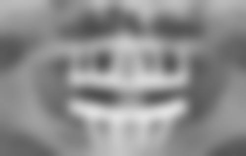 开眼角与割双眼皮费用大揭秘！了解价格区间及优质医院医生选择攻略 