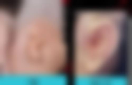 六、济南艺星医疗美容医院怎么预约：