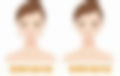 五、菏泽市悦美美容医院怎么预约：