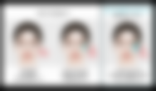 如何去除双眼皮白色疤痕？专精医美方案来帮忙