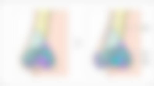 做完双眼皮眼睛和眉毛更近?选对医院特别重要