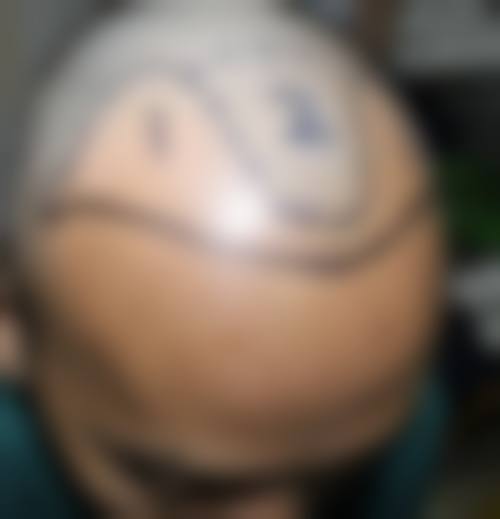 徐开业怎么预约?