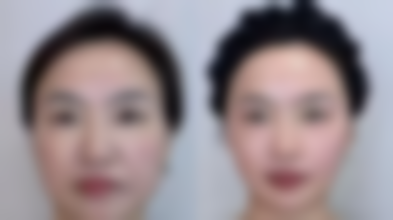 五、佛山广大壹美医疗美容整形门诊部实例