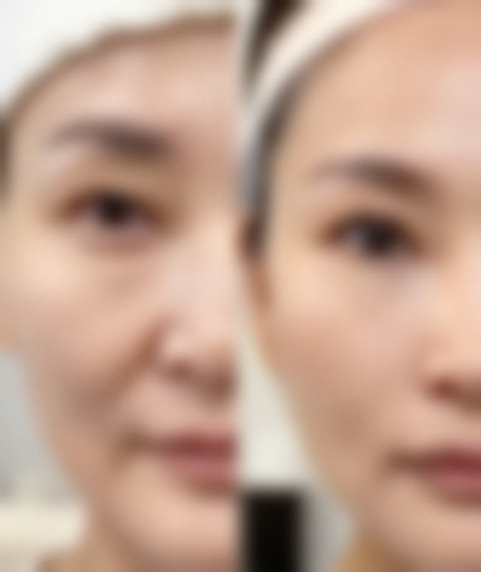 五、广元大华整形美容诊所实例