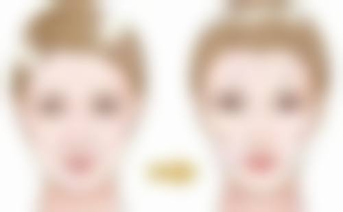 医院助力，焕美无忧——选择靠谱医院打瘦脸针