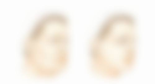 总结：假体隆胸后背挺不直不用慌