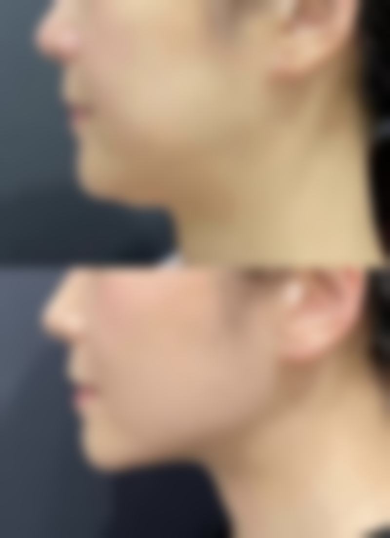 五、广州军美医疗美容怎么预约：