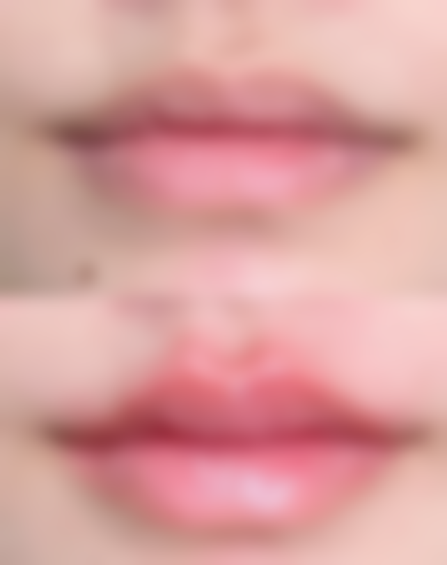 疤痕长疙瘩原因揭秘：遗传、损伤等因素作祟，多疗法助你改善疤痕疙瘩 