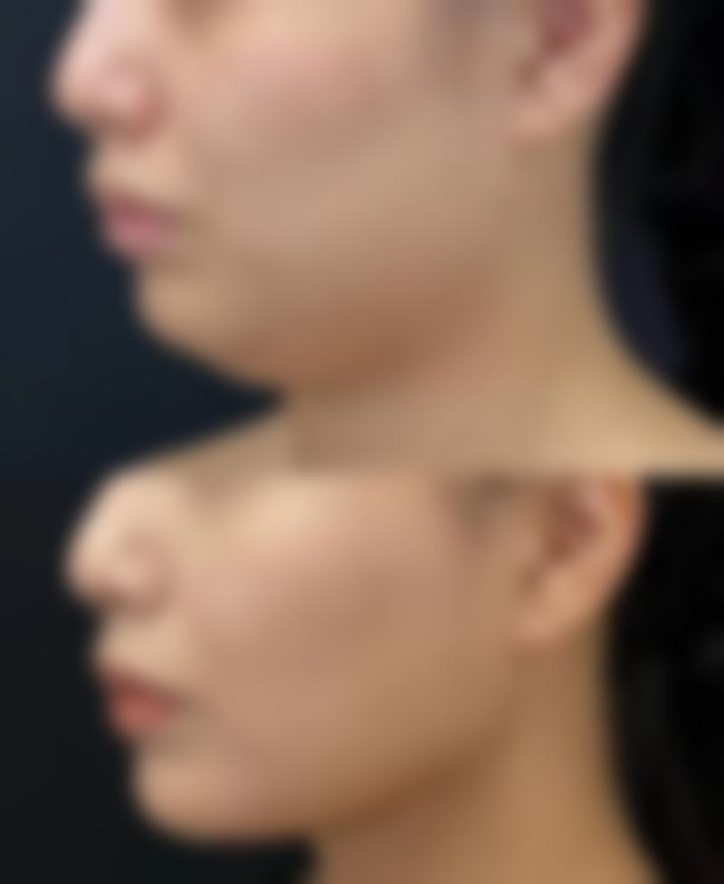 想淡化缝针疤痕？医院的技术实力与规模