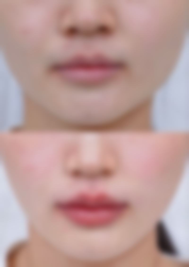 八、青岛铭妍医疗美容诊所真实的顾客评价如下: