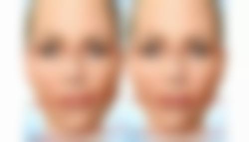 南京同仁堂蛇毒眼霜实际使用成效如何，真能去眼袋吗？