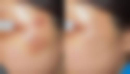 修复注意事：细节之处见成效