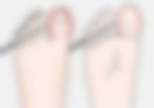 如何让凸出疤痕变平？美学与风险要兼顾