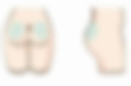 术后1 - 3天:千万别直接吹风