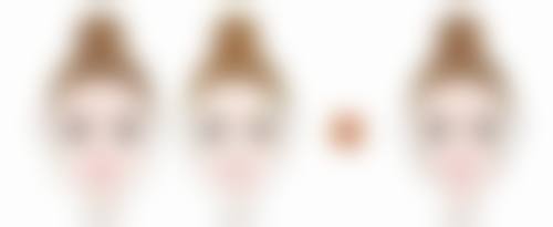 天生黑眼袋难消除？分型施策+医美助力，还你明亮有神双眸 