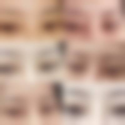 沈珍熙眼部整形水平怎么样可靠吗？