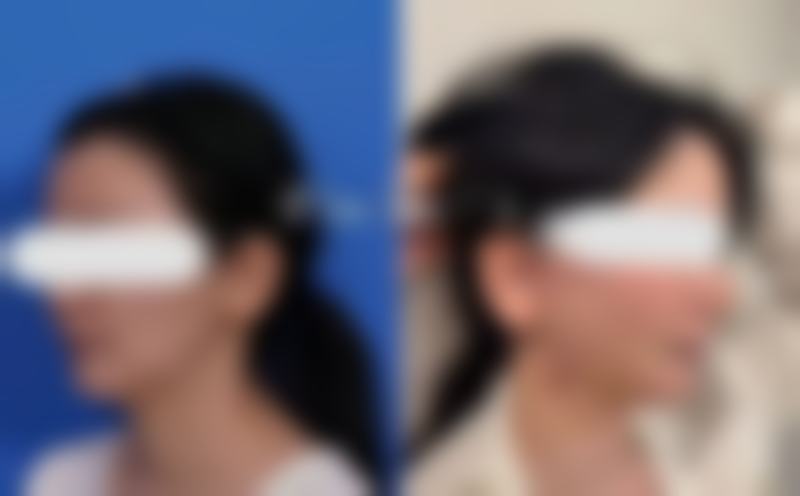 韩昇烈项目价格表参考