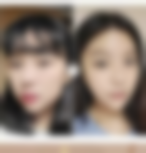 重拾肌肤自信与舒适，告别疤痕疙瘩烦恼