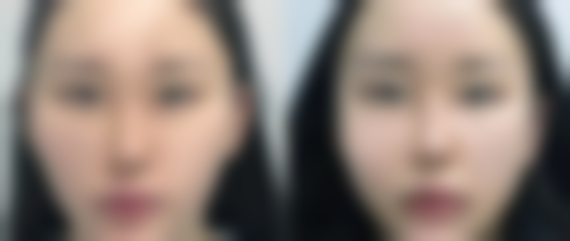 郑甫滥怎么预约？