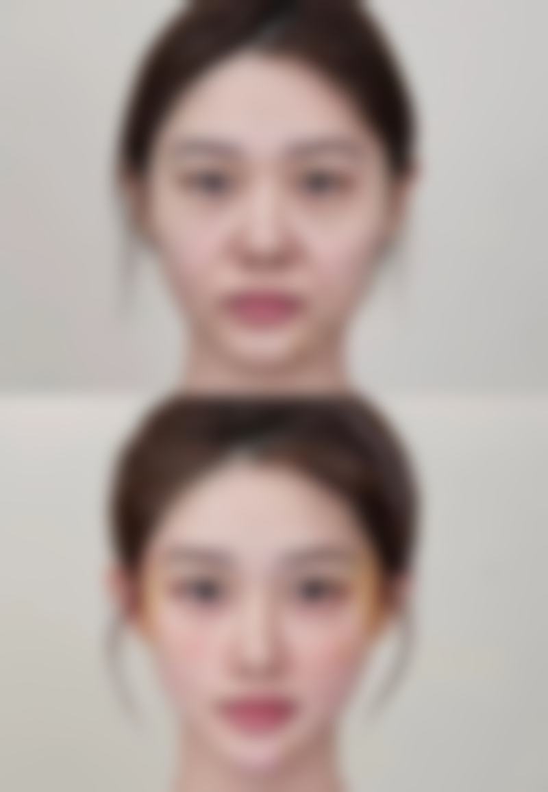 四、郑州帝尔美整形美容门诊部实例