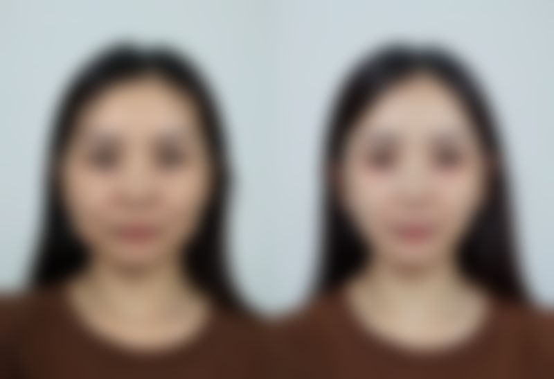 七、answer整形外科真实的顾客评价如下：