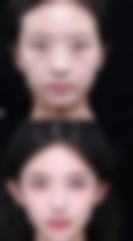 正规医院选择要点：保护成效与安心