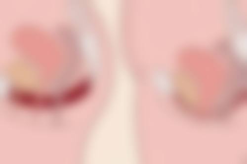 术后修复小贴士：全方面呵护肌肤