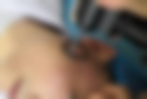 坚持就是胜利，告别“熊猫眼”焕亮双眸