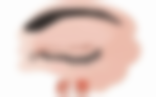 四、沈阳爱心女子医院整形科实例