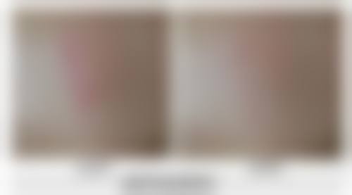 五、广州后勤医院整形美容中 心怎么预约：