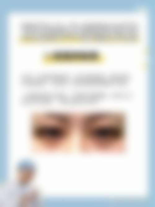 李惠圆眼部整形水平怎么样可靠吗？