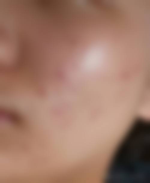 周海燕怎么预约？