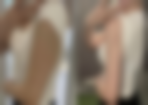 如何巧妙修复腋下手术疤痕？常见治疗方法大揭秘