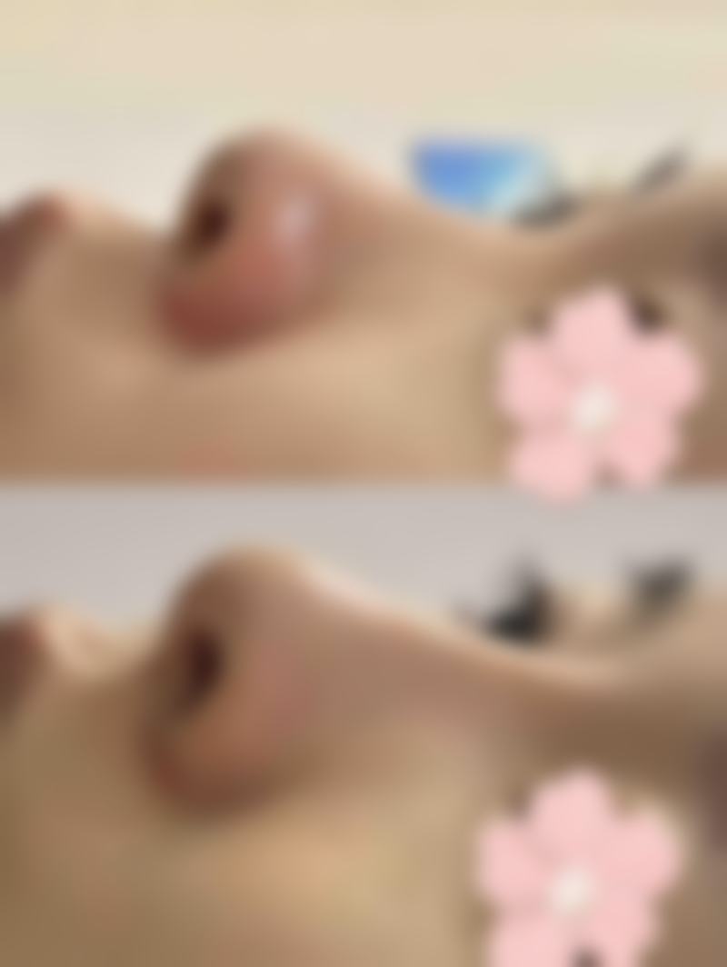 日常维护，巩固去除眼袋和黑眼圈的成效